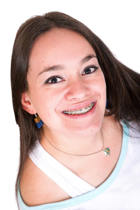 girl with braces smiling big over a white background - clipping path included with high detail on the hair so you can easily place any background