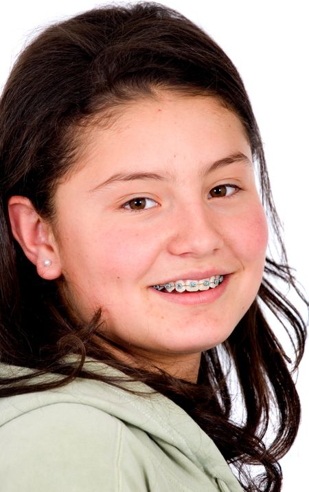 beautiful female teen portrait smiling and showing her braces - isolated over a white background