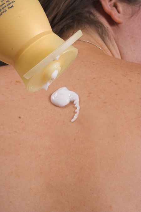 cream being applied to a woman's back