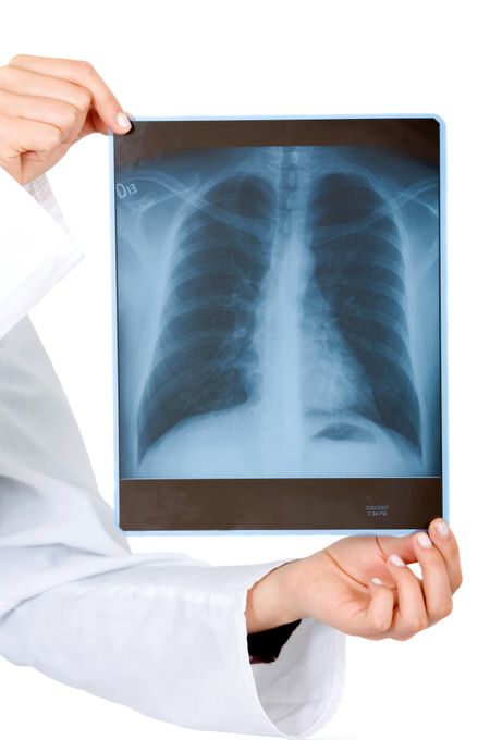 xray held by hands isolated over a white background